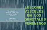 Lesiones visibles en los genitales femeninos
