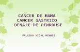 Cancer de mama y gastrico
