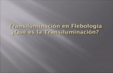 TransiluminacióN En FlebologíA