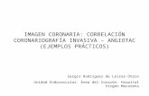 Correlacion angiotac y coro invasiva hospital virgen macarena