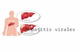 Hepatitis virales