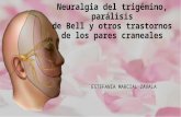 Neuralgia del trigémino, parálisis de bell y otros transtonos