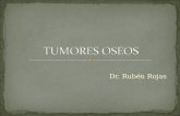 Tumores oseos-upap