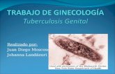 Tuberculosis genital