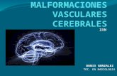 Malformaciones vasculares cerebrales