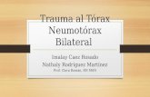 Neumotorax bilateral