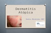 Dermatitis atópica por Nadia Menéndez Auld