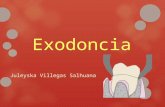 Villegas salhuana   exodoncia