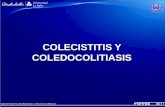 Colecistitis y coledocolitiasis