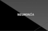 1p neumoniaenpediatria-091014225641-phpapp01