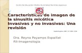 Características de imagen de la sinusitis micótica invasivas 1