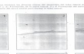 Defectos de tubo neural - FISIOPATOLOGIA II, PARCIAL 2