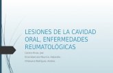Lesiones de la cavidad oral, enfermedades reumatológicas