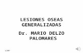 Lesiones Oseas Generalizadas-md