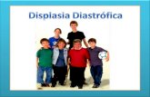 displasia diastrofica