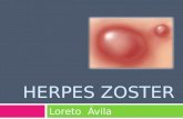 Herpes zoster.pptx