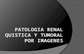 Patologia Renal