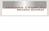 Herpes (Tipo 2)