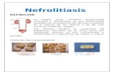 nefrolitiasis word.docx