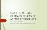Manifestaciones Dermatologicas de Anemia Ferropenica