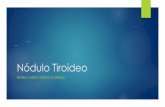 Nódulo Tiroideo