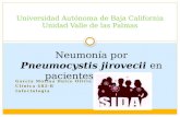Neumonía Por Pneumocystis Jirovecii en Pacientes Con VIH