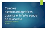 Cambios Electrocardiográficos Durante El Infarto Agudo de Miocardio