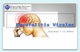 Encefalitis Virales