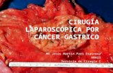 Cirugía Laparoscópica Por Cáncer Gastrico