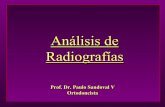 Análisis Radiográfico (1).pdf