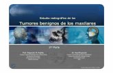 Tumores Benignos de los Maxilares RX