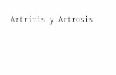 Artritis y Artrosis