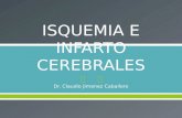 INFARTO CEREBRAL - copia.pptx