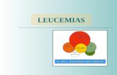 Leucemias1 4 TEMA