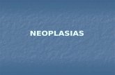 Neoplasia s