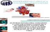 Enfermedad Cardiaca Congenita Cianogenas