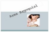 Expo Asma Bronquial(2)