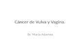 Cancer de Vagina y Vulva