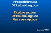 (2)Exploración Oftalmológica Macroscopica
