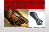 Historia de Las Protesis