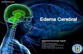 Neurocirugia - Edema Cerebral