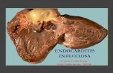 Endocarditis infecciosa - Dr. Josías Ríos Ortega
