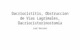 Dacriocistitis, Obstruccion de Vias Lagrimales, Dacriocistorinostomia
