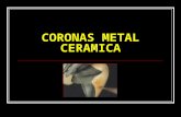 Coronas Metal Ceramica
