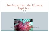 24.-Perforación de Ulcera Péptica