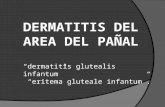 Dermatitis del area del pañal