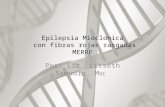 Epilepsia Mioclonica Con Fibras Rojas Rasgadas