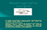 Radiografía carpal