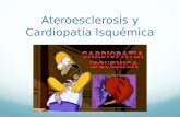 Ateroesclerosis y cardiopatia Isquemica