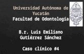 Gutiérrez emiliano caso#4 prótesis inmediata y protesis parcial removible.ppt